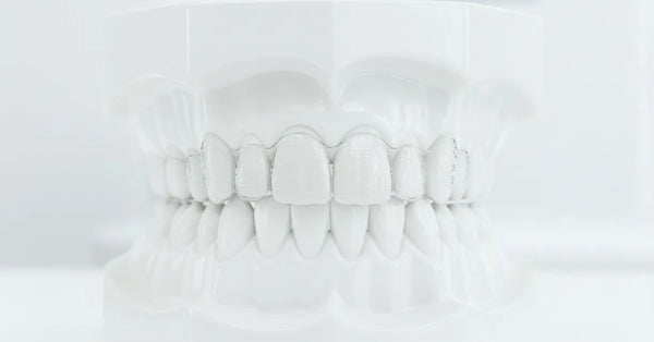 Are Clear Aligners Safe? Teeth Straightening Guide - NewSmile Canada