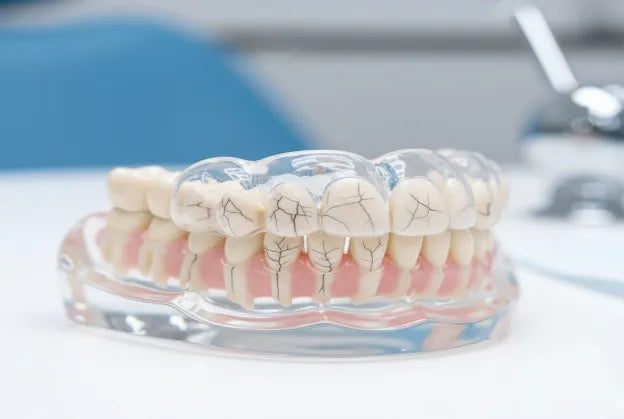 Close-up of a night guard resting on cracked enamel model