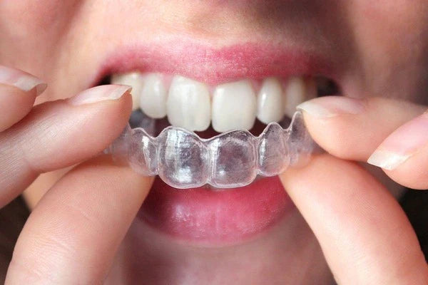 How Do I Remove Stuck Aligners?