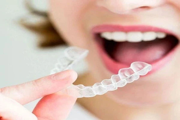 😬 Why Do My Clear Retainers Feel So Tight Sometimes?