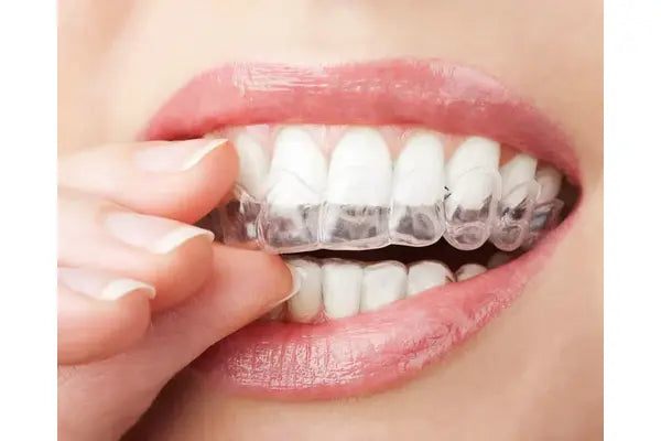 The Clear Retainer Lifestyle: How to Keep Your Smile Straight, Confident, and Low-Maintenance