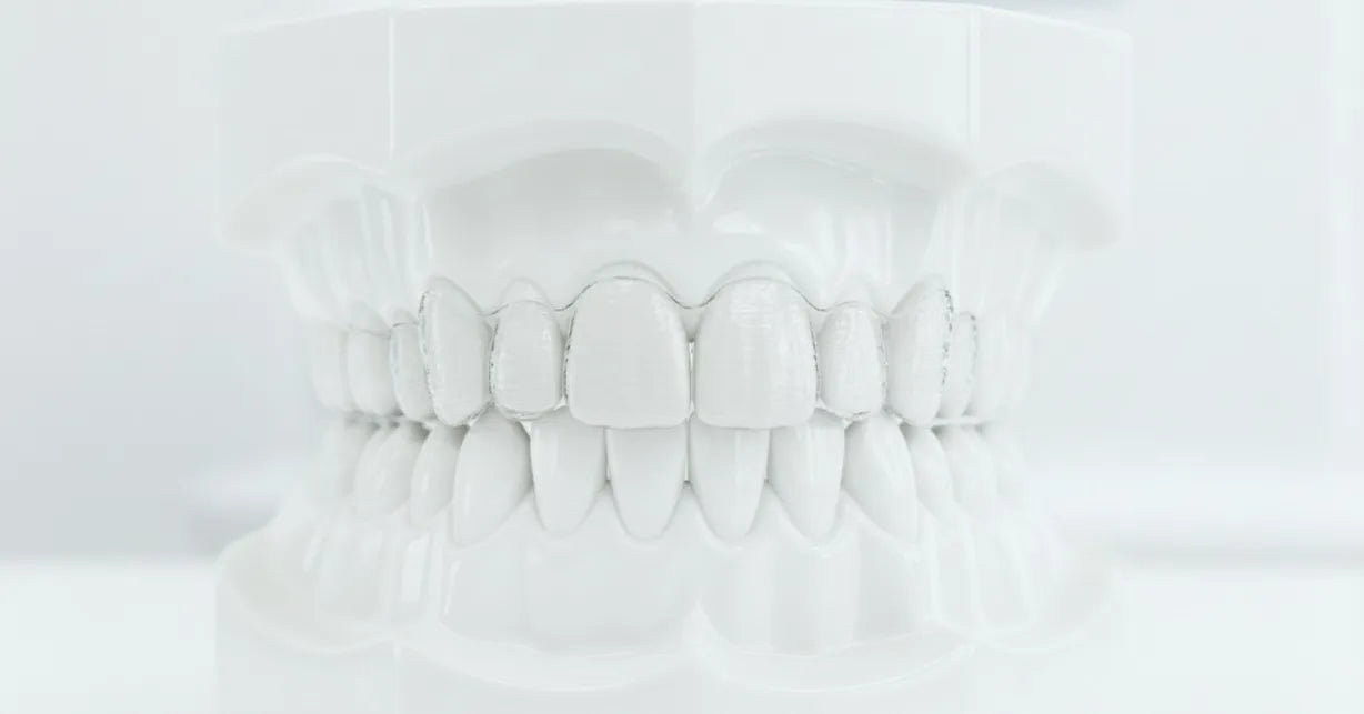Transparent clear aligners for teeth straightening on a dental model