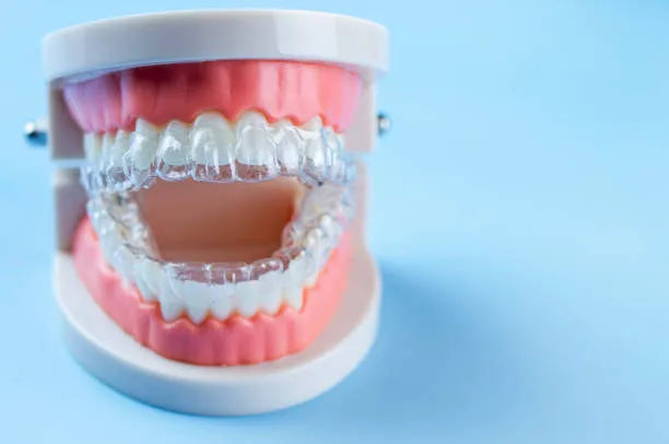 Clear dental retainer on teeth model for overbite treatment options