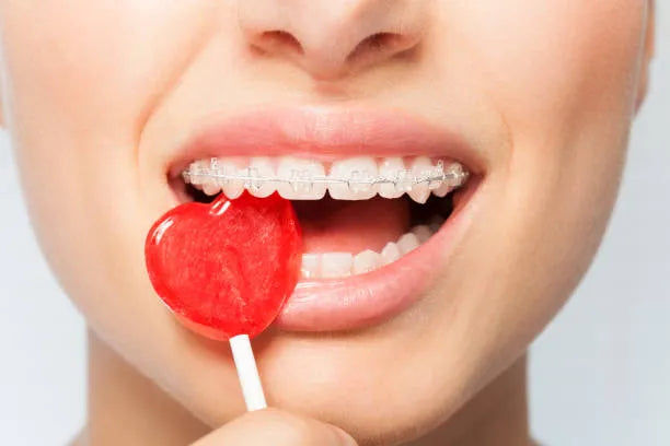 Eating lollipops with braces safely