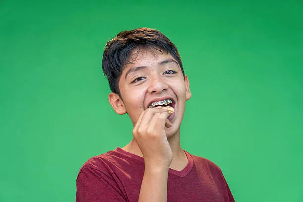 Eating soft snacks with braces safely