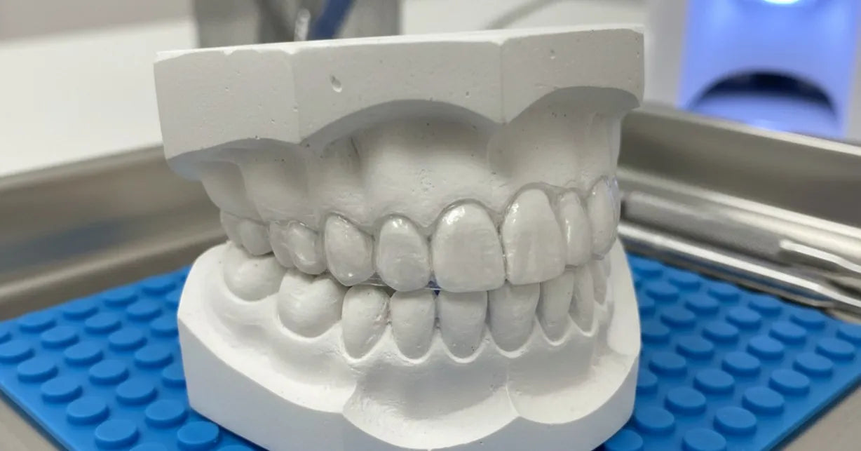 What Are Dental Night Guards and How Do They Work? - NewSmile Canada