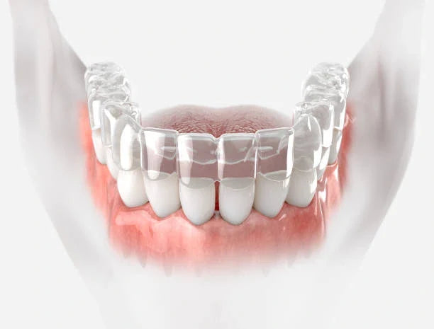 😁 Gap Teeth: Can Retainers Close Them?