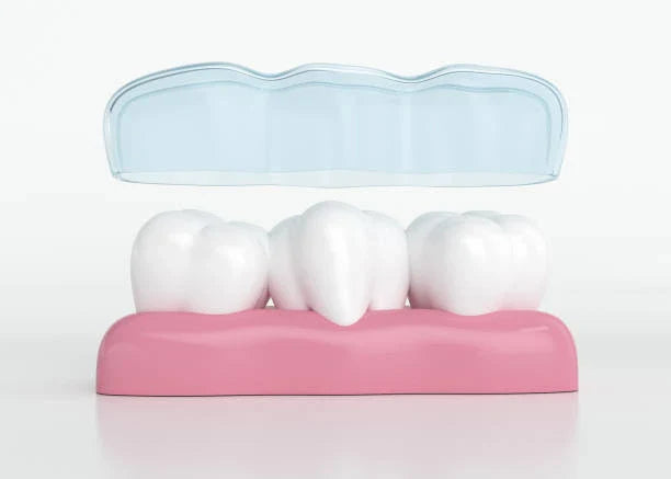 🌿 Gum Recession: Can Retainers Prevent It?