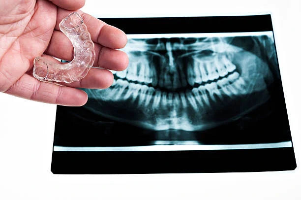 🦷 Broken Teeth from Retainers: Myth or Reality?