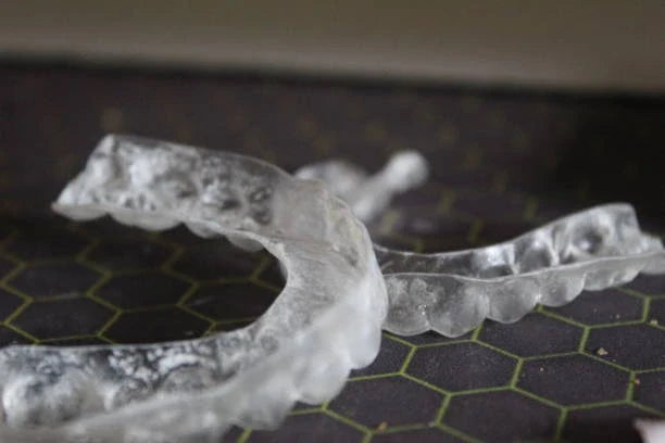 ⏳ Retainer Lifespan: When to Replace Yours