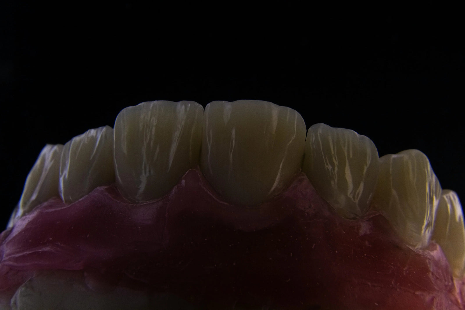 The Silent Sculptor: How Retainers Quietly Reshape More Than Just Teeth