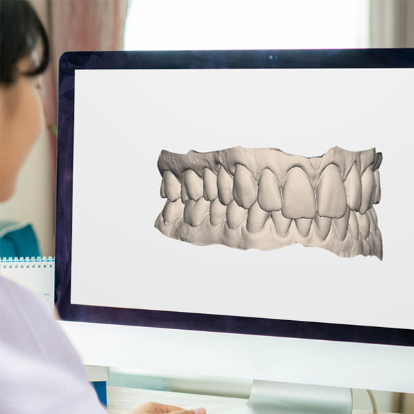 Before After 3D Treatment Preview By Our Licensed Dentists and Orthodontists - NewSmile
