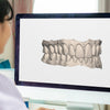 Before After 3D Treatment Preview By Licensed Dentists & Orthodontists - NewSmile